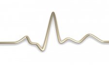 side effects of amiodarone ekg