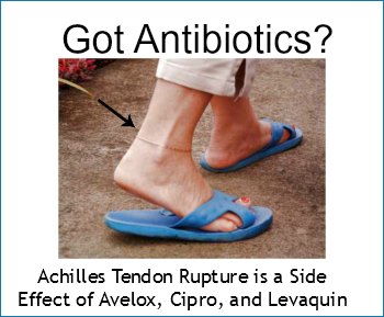 achilles tendon rupture is a side effect of avelox, cipro, and levaquin