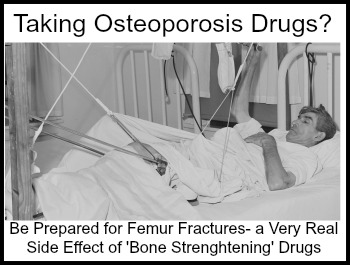 femur fracture is a very real side effect of osteoporosis drugs and bisphosphenates