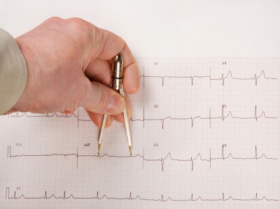 A prolonged qt interval can be deadly side effects of many different drugs. long qt syndrome, side effect